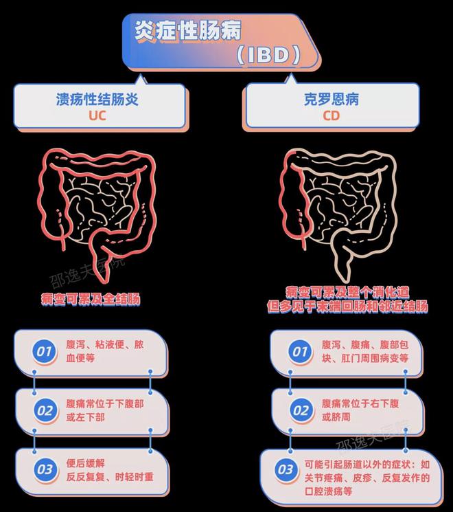 克罗恩肠炎吃什么好_克罗恩吃肠炎宁有用吗_肠炎克罗恩能治好吗