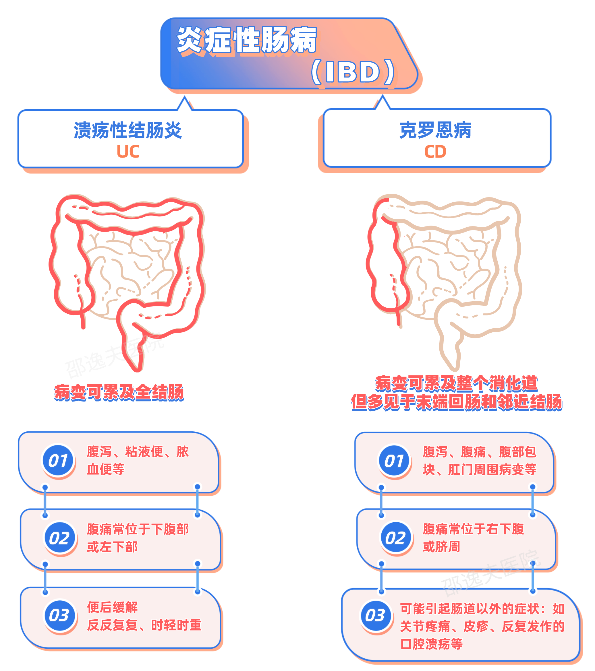 克罗恩病患者_罗克罗恩病的特征性体征_罗克罗恩病