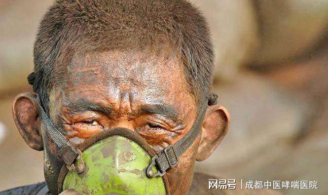 肺结核三型会死人吗_死人肺结核型会复发吗_有肺结核的人死后会有传染性吗