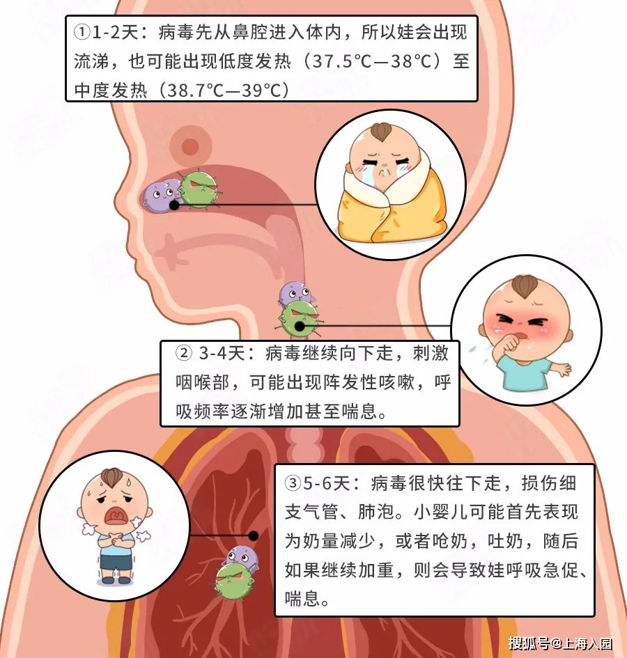 肺炎治疗儿童的药物_儿童肺炎治疗_儿童肺炎怎么治疗